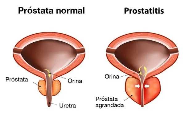 Uroxel en Farmacia Del Ahorro: Precio y Disponibilidad